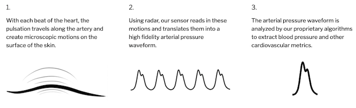 Bezkontaktní analýza krevního tlaku pomocí 60 GHz CW radaru.