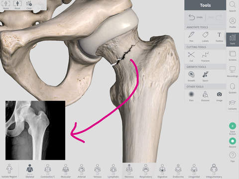 full-anatomy-ipad-2
