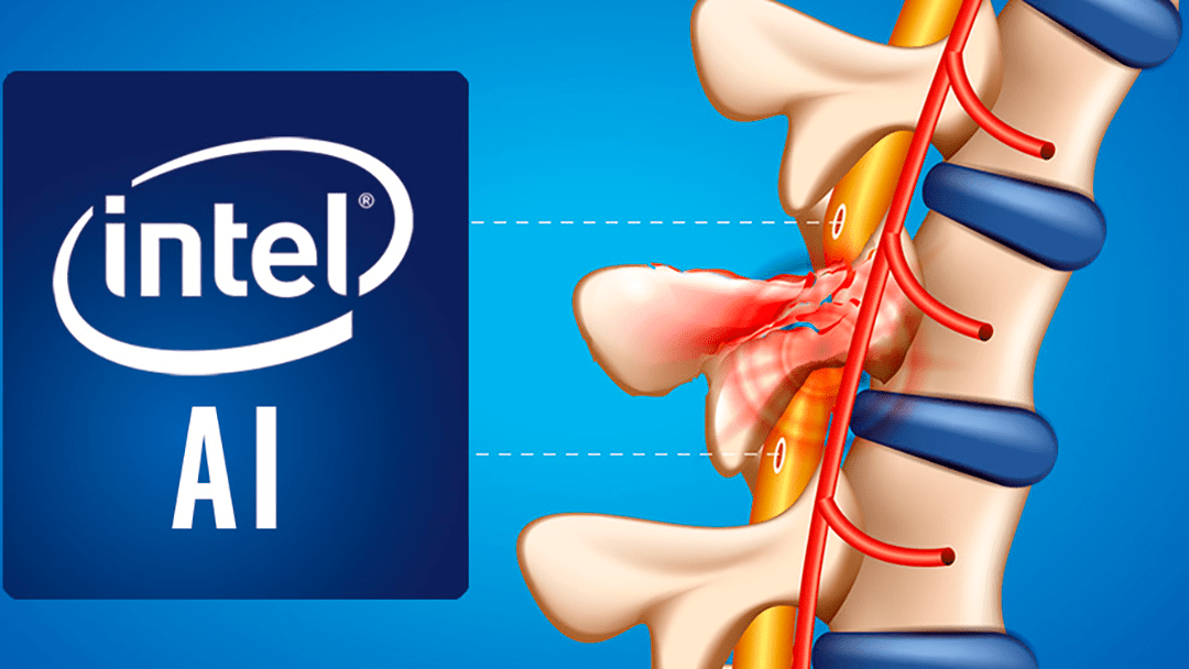 Intel chce použít umělou inteligenci k léčení poranění míchy. V současné době pracuje na inteligentním rozhraní, které dokáže ovládat páteř a močový měchýř.