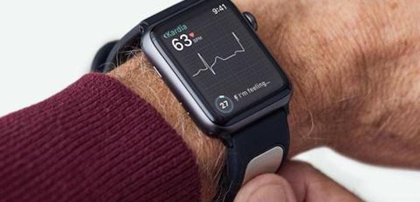 KardiaBand vám také umožňuje vzít EKG s hodinkami Apple Watch.